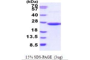 SDS-PAGE (SDS) image for CD58 (CD58) (AA 29-215) protein (His tag) (ABIN5854000) (CD58 Protein (CD58) (AA 29-215) (His tag))