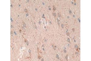 Used in DAB staining on fromalin fixed paraffin- embedded brain tissue (Glutamate Receptor 3 Antikörper  (AA 649-823))