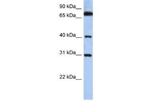 WB Suggested Anti-DHRSX Antibody Titration: 0. (DHRSX Antikörper  (C-Term))