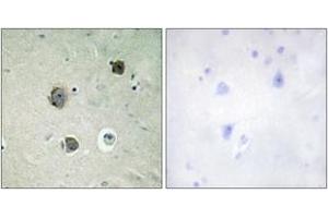 Immunohistochemistry analysis of paraffin-embedded human brain tissue, using CDK5 (Ab-15) Antibody. (CDK5 Antikörper  (AA 1-50))