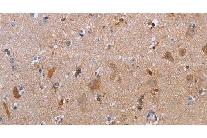Immunohistochemistry of paraffin-embedded Human brain using MAGEF1 Polyclonal Antibody at dilution of 1:30 (MAGEF1 Antikörper)