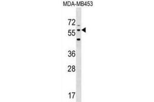 Western Blotting (WB) image for anti-Leucine Rich Repeat Transmembrane Neuronal 2 (LRRTM2) antibody (ABIN3000490) (LRRTM2 Antikörper)