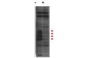 Western blot using  affinity purified anti-MLF1IP / PBIP1 antibody shows detection of endogenous MLF1IP protein (a tier of four modified protein bands indicated by the arrowheads) in lysates of Hela cells (- lane). (MLF1 Antikörper  (N-Term))