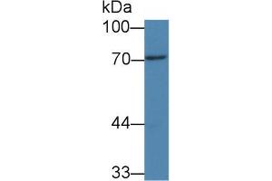 Western blot analysis of Rat Bladder lysate, using Human PADI3 Antibody (3 µg/ml) and HRP-conjugated Goat Anti-Mouse antibody (