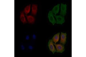 ABIN6263362 and ABIN6279017 staining Hela cells by IF/ICC. (MRPL19 Antikörper  (Internal Region))