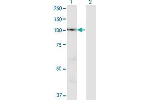 Western Blot analysis of VPS41 expression in transfected 293T cell line by VPS41 polyclonal antibody (A01). (VPS41 Antikörper  (AA 755-853))