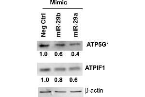 miR-29-b-1/a downregulate ATP5G1 and ATPIF1 protein expression in LCC9 breast cancer cells. (ATP5G1 Antikörper  (Center))