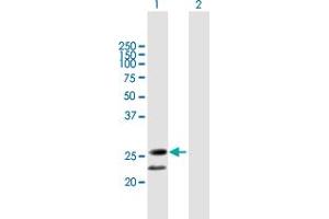 Western Blot analysis of C20orf71 expression in transfected 293T cell line by C20orf71 MaxPab polyclonal antibody. (BPIFA3 Antikörper  (AA 1-218))