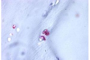 Immunohistochemistry (Formalin/PFA-fixed paraffin-embedded sections) of human cartilage tissue with ACAN polyclonal antibody . (Aggrecan Antikörper  (C-Term))