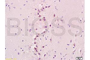 SLC5A5 Antikörper  (AA 525-618)