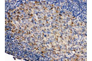 Immunohistochemistry (Paraffin-embedded Sections) (IHC (p)) image for anti-CD19 Molecule (CD19) (AA 307-337), (Middle Region) antibody (ABIN3043389) (CD19 Antikörper  (Middle Region))