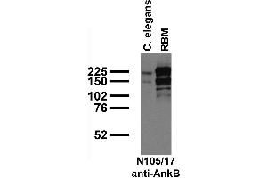 Immunoblot against crude C.