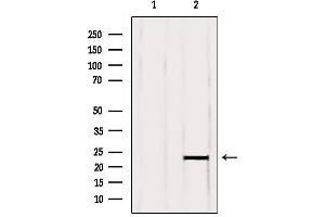 Western blot analysis of extracts from Mouse brain, using RBBP9 Antibody.