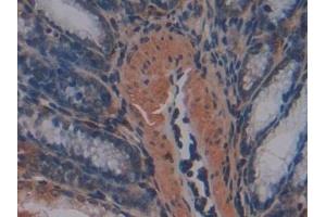 Immunohistochemistry (IHC) image for anti-Matrix Metallopeptidase 7 (Matrilysin, Uterine) (MMP7) (AA 1-264) antibody (ABIN7431017)