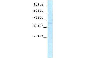 WB Suggested Anti-NLRC4 Antibody Titration: 0. (NLRC4 Antikörper  (C-Term))