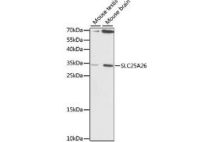 Western blot analysis of extracts of various cell lines, using SLC25A26 antibody. (SLC25A26 Antikörper)