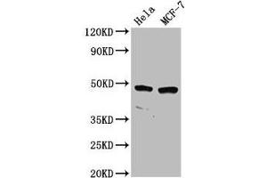 Western Blot Positive WB detected in: Hela whole cell lysate, MCF-7 whole cell lysate All lanes: NSUN5 antibody at 2. (NSUN5 Antikörper  (AA 362-466))
