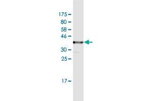 Western Blotting (WB) image for anti-T-Cell, Immune Regulator 1, ATPase, H+ Transporting, Lysosomal V0 Subunit A3 (TCIRG1) (AA 121-220) antibody (ABIN523715)