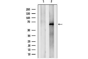 anti-Insulin-Like Growth Factor 2 mRNA Binding Protein 1 (IGF2BP1) (N-Term) antibody