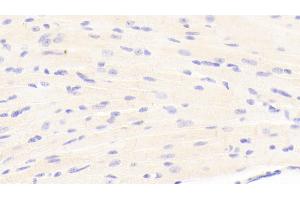 Detection of LAMb1 in Mouse Cardiac Muscle Tissue using Polyclonal Antibody to Laminin Beta 1 (LAMb1) (Laminin beta 1 Antikörper  (AA 1053-1258))