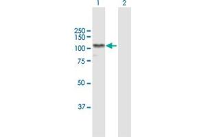 Western Blotting (WB) image for anti-Alanyl tRNA Synthetase (AARS) (AA 1-968) antibody (ABIN947523)