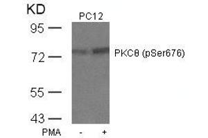 Western blot analysis of extracts from PC12 cells untreated or treated with PMA using PKCth(Phospho-Ser676) Antibody. (PKC theta Antikörper  (pSer676))