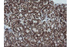 Image no. 9 for anti-NADH Dehydrogenase (Ubiquinone) 1 beta Subcomplex, 10, 22kDa (NDUFB10) antibody (ABIN1499669)