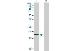 Western Blot analysis of AHNAK expression in transfected 293T cell line by AHNAK MaxPab polyclonal antibody.
