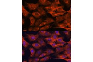 Immunofluorescence (IF) image for anti-Mucosa Associated Lymphoid Tissue Lymphoma Translocation Gene 1 (MALT1) (AA 125-450) antibody (ABIN3023032)