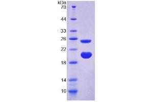 SDS-PAGE analysis of Rat AVPI1 Protein. (AVPI1 Protein)