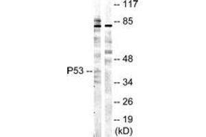 Western blot analysis of extracts from COS7 cells, treated with UV 5', using p53 (Ab-20) Antibody. (p53 Antikörper  (AA 10-59))