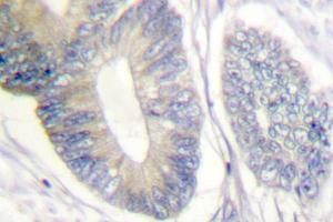 Image no. 1 for anti-SHC (Src Homology 2 Domain Containing) Transforming Protein 1 (SHC1) antibody (ABIN271910) (SHC1 Antikörper)