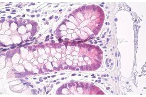 anti-Glutathione Peroxidase 2 (GPX2) antibody