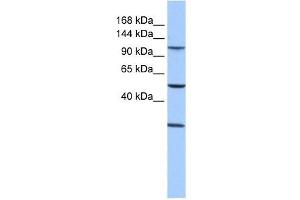 STAG3 antibody used at 1 ug/ml to detect target protein. (STAG3 Antikörper  (Middle Region))