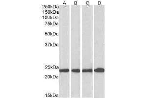 Western Blotting (WB) image for anti-Superoxide Dismutase 2, Mitochondrial (SOD2) (AA 119-130) antibody (ABIN768566)