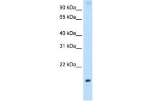 Western Blotting (WB) image for anti-Protein Phosphatase 1, Regulatory Subunit 8 (PPP1R8) antibody (ABIN2462127) (PPP1R8 Antikörper)