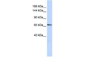 WB Suggested Anti-RBM26 Antibody Titration:  0. (RBM26 Antikörper  (Middle Region))