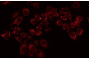 ABIN6276072 staining LOVO by IF/ICC. (OR11L1 Antikörper  (Internal Region))