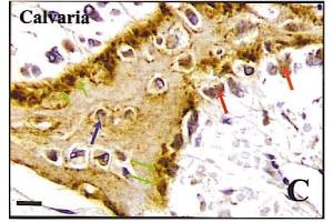Immunohistochemistry image of BSP staining in paraffn sections of human calvaria.