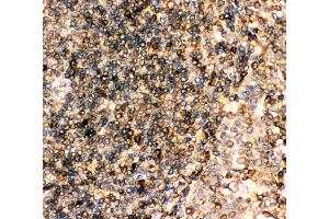 Anti-CD23 Picoband antibody,  IHC(P): Human Tonsil Tissue (FCER2 Antikörper  (AA 50-331))