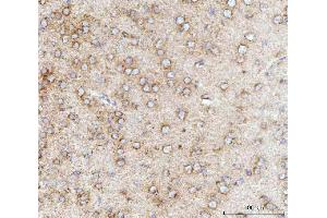 IHC analysis of MFF using anti-MFF antibody (ABIN7599292).