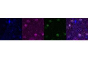 Immunohistochemistry (IHC) image for anti-SATB Homeobox 2 (SATB2) antibody (ABIN7456088) (SATB2 Antikörper)