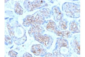 Immunohistochemistry (IHC) image for anti-Periostin (POSTN) (AA 193-326) antibody (ABIN7504148)