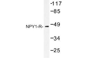Image no. 1 for anti-Neuropeptide Y Receptor 1 (NPY1R) antibody (ABIN317656) (NPY1R Antikörper)