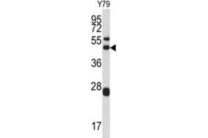 Western Blotting (WB) image for anti-Actin Related Protein 2/3 Complex, Subunit 1A, 41kDa (ARPC1A) antibody (ABIN3002660) (ARPC1A Antikörper)