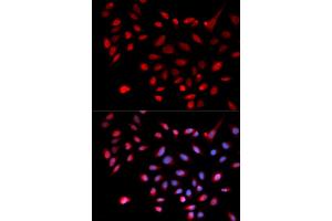 Immunofluorescence analysis of U2OS cells using CDK9 antibody (ABIN5970745). (CDK9 Antikörper)