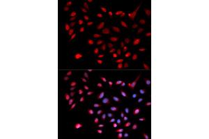 Immunofluorescence analysis of U2OS cells using CDK9 antibody (ABIN5970745). (CDK9 Antikörper)