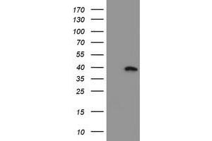 Western Blotting (WB) image for anti-Myeloid Leukemia Factor 1 (MLF1) antibody (ABIN1499496) (MLF1 Antikörper)