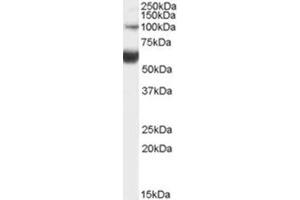 Image no. 1 for anti-HNF1 Homeobox B (HNF1B) (Internal Region) antibody (ABIN375249) (HNF1B Antikörper  (Internal Region))