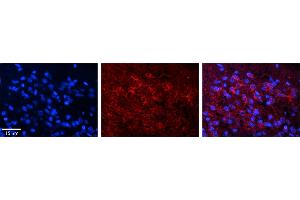 Rabbit Anti-DND1 Antibody     Formalin Fixed Paraffin Embedded Tissue: Human Pineal Tissue  Observed Staining: Cytoplasmic in pinealocytes  Primary Antibody Concentration: 1:100  Other Working Concentrations: 1/600  Secondary Antibody: Donkey anti-Rabbit-Cy3  Secondary Antibody Concentration: 1:200  Magnification: 20X  Exposure Time: 0. (DND1 Antikörper  (C-Term))